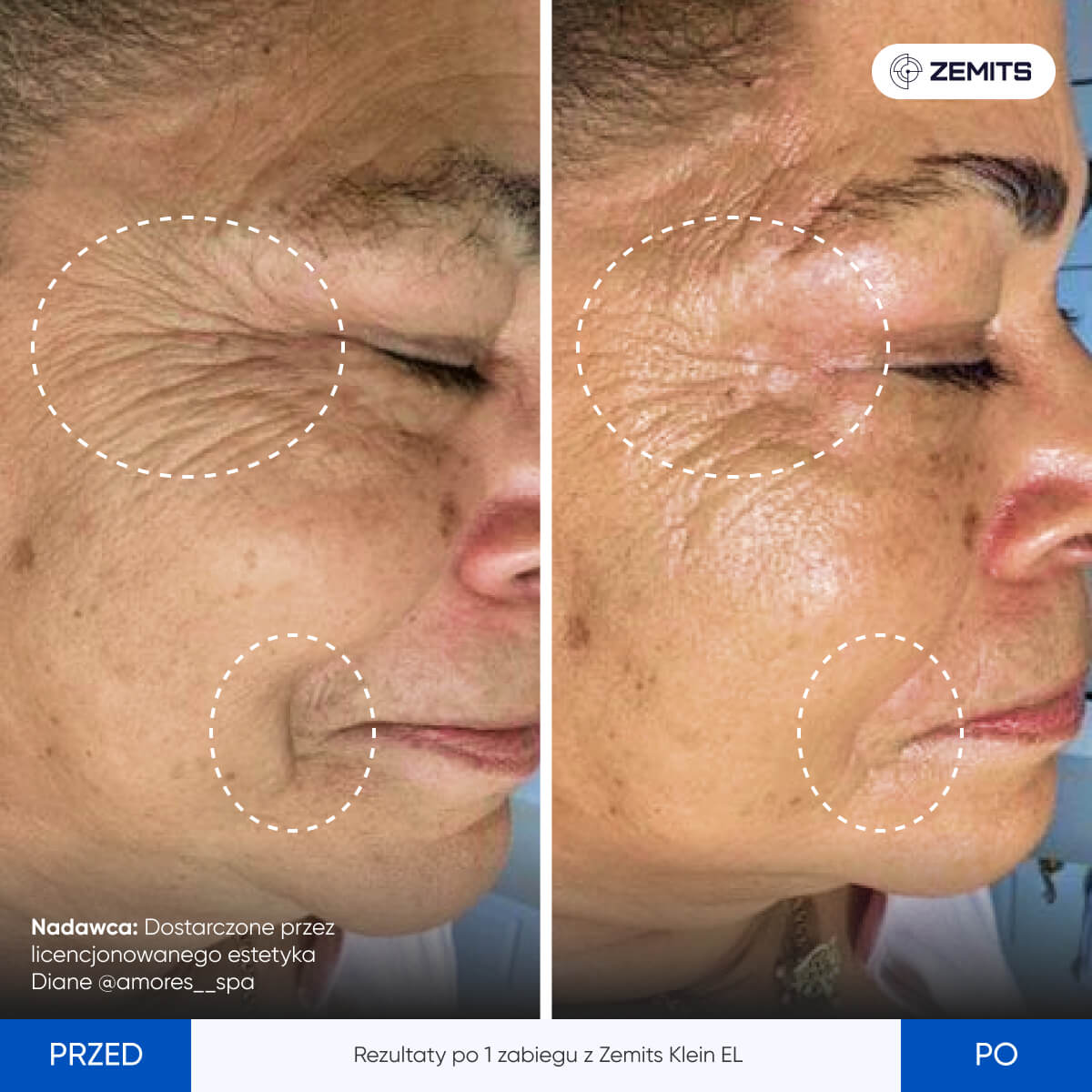 Before After Slide 5