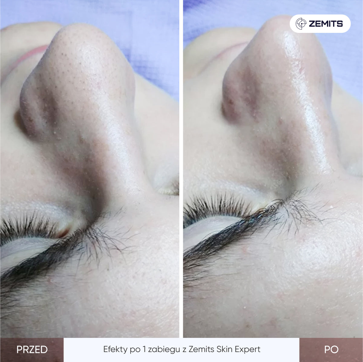 Before After Slide 3