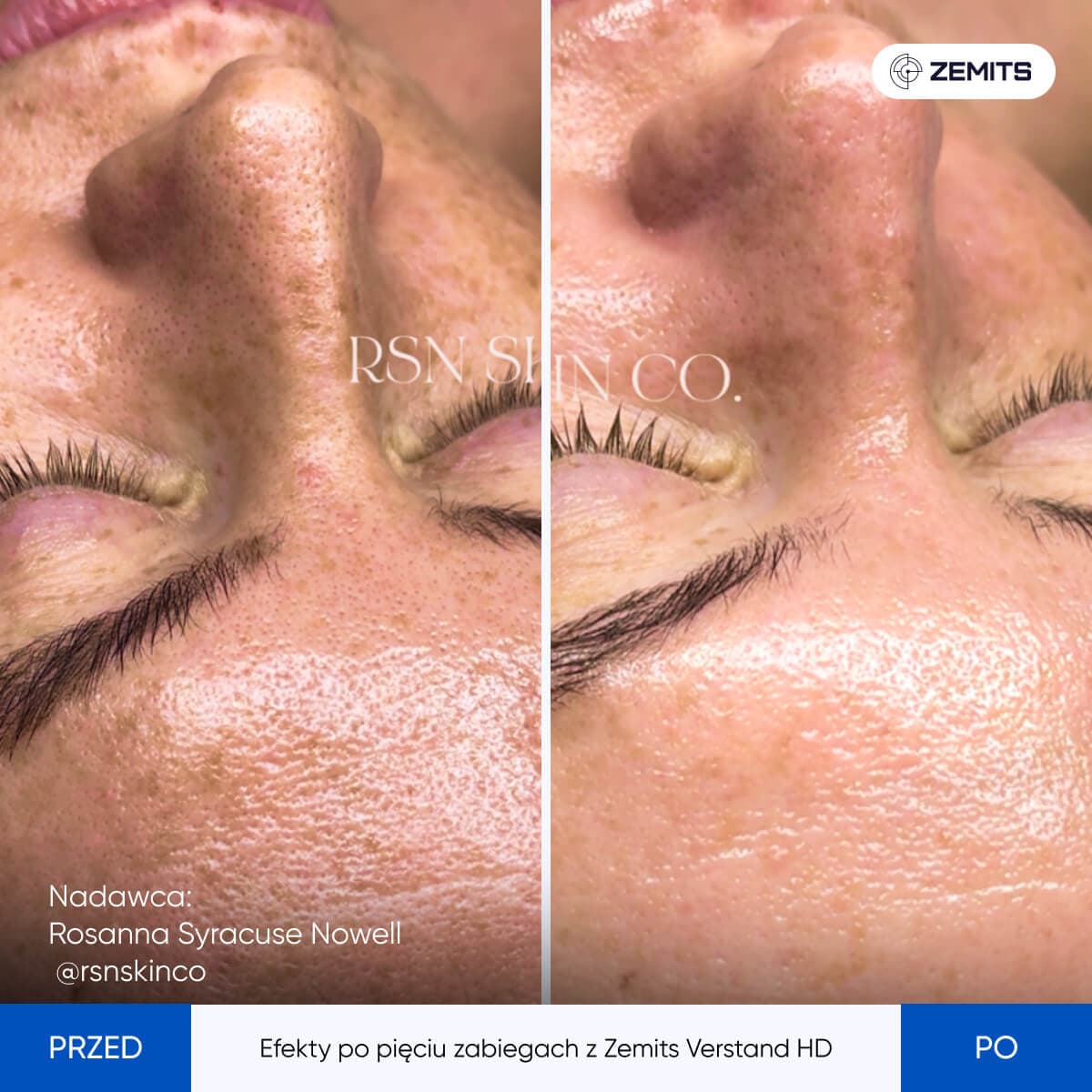 Before After Slide 5