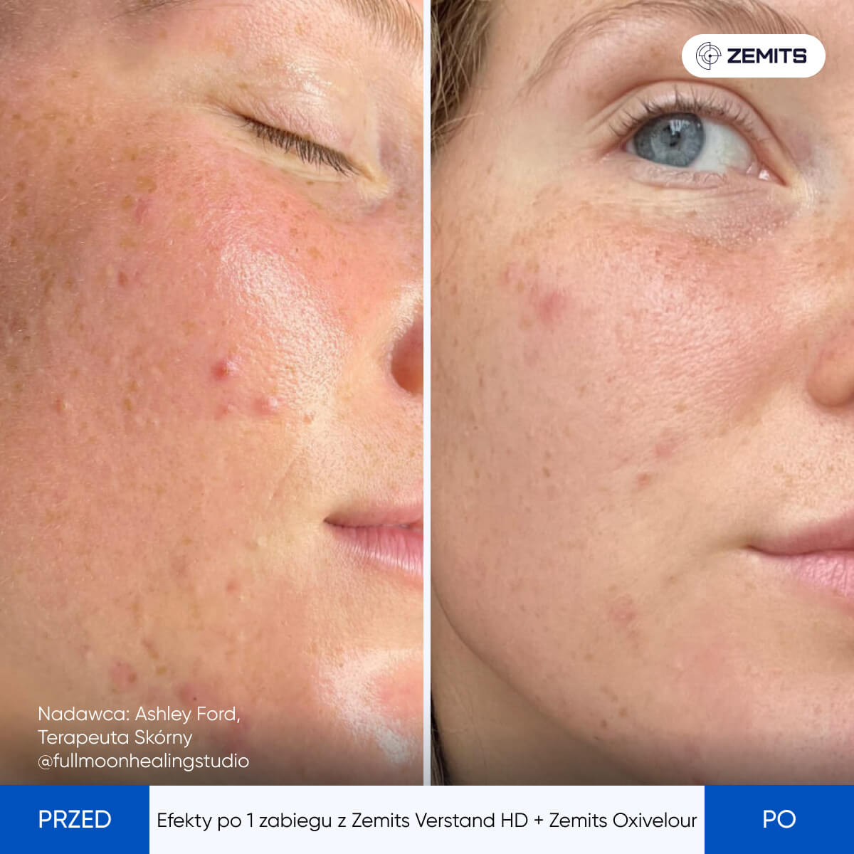 Before After Slide 7