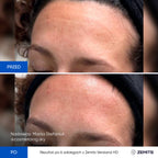 Zemits Verstand HD