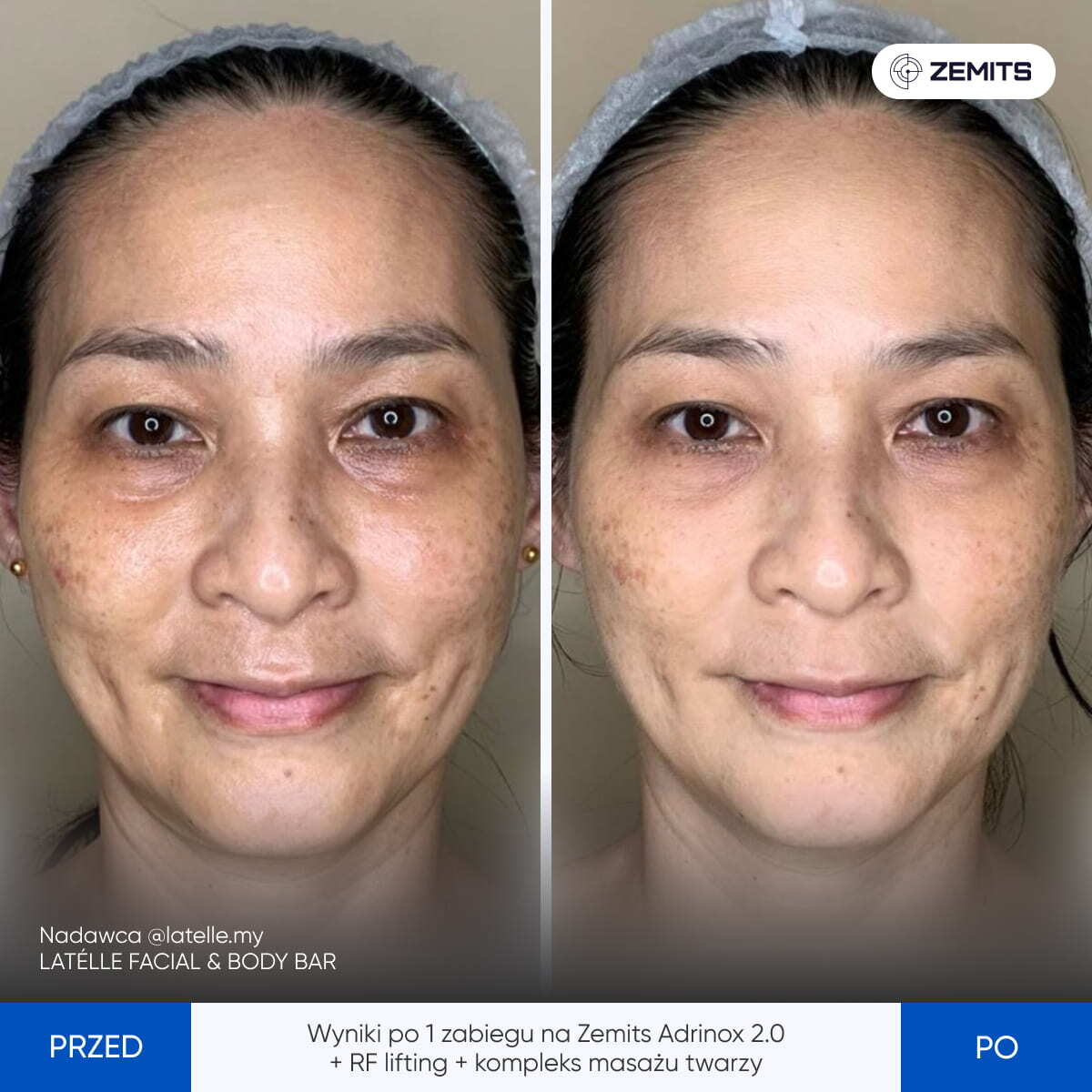 Before After Slide 7