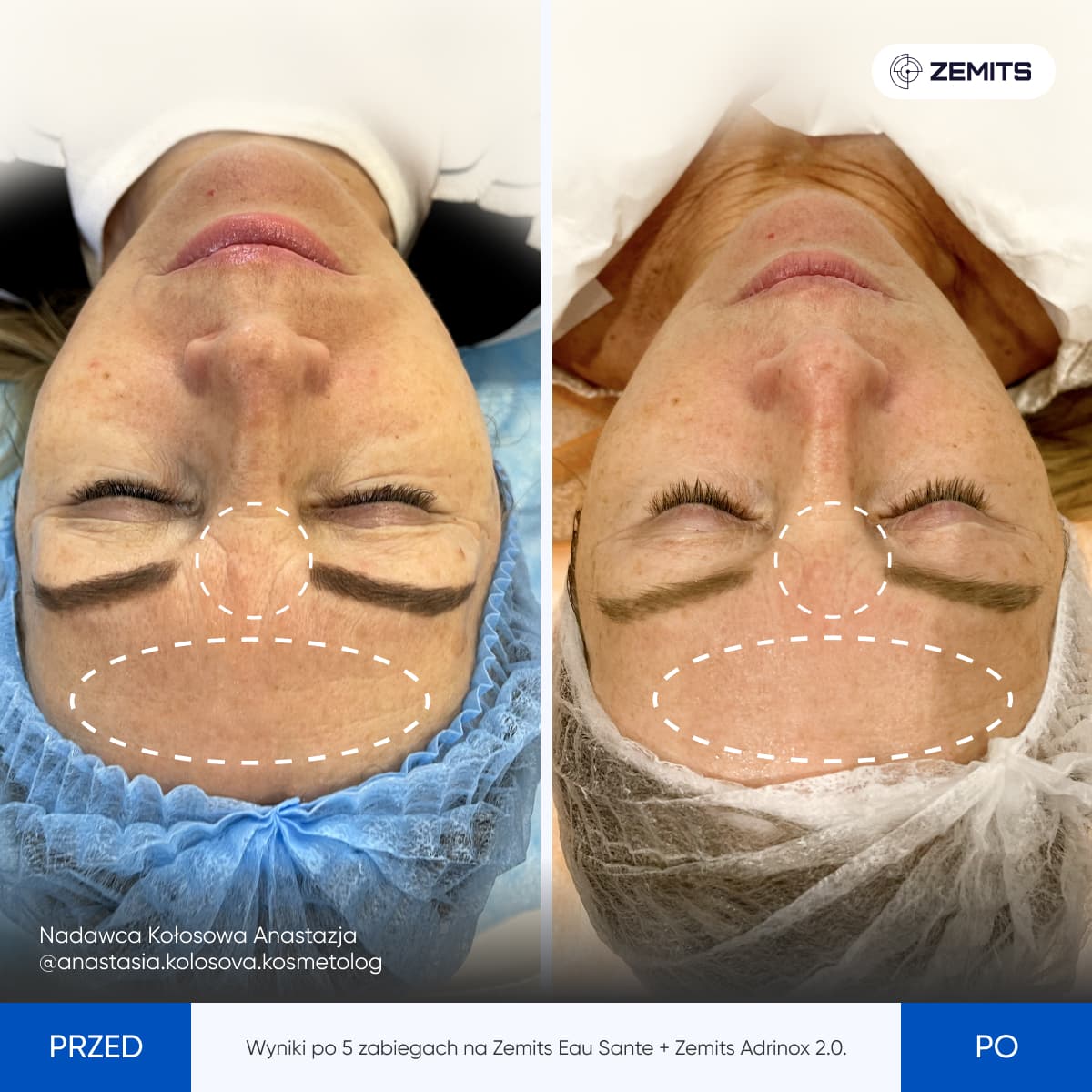 Before After Slide 9