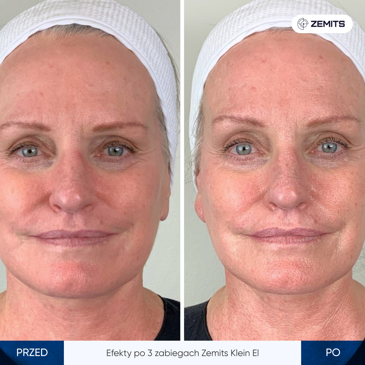 Before After Slide 7