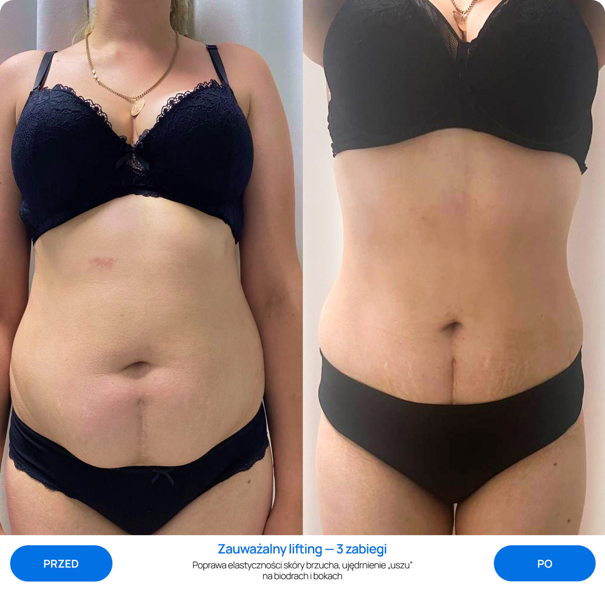 Before After Slide 2