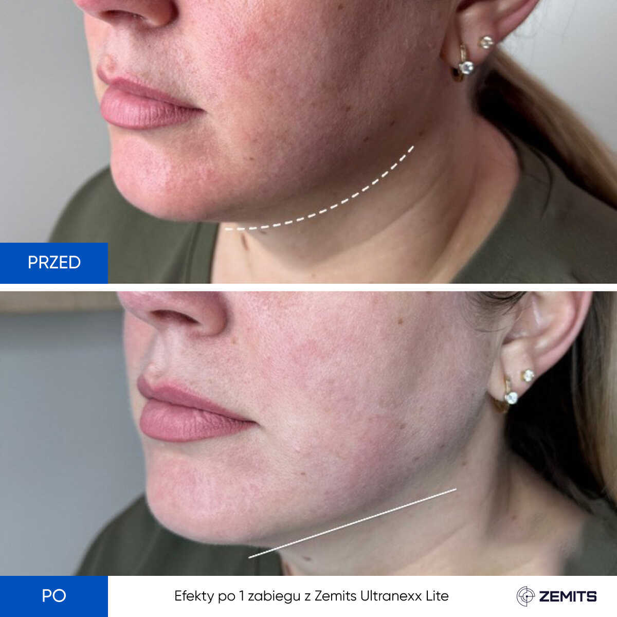 Before After Slide 7